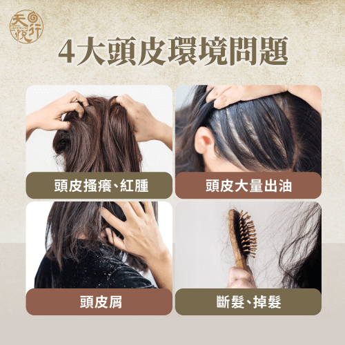 頭皮搔癢、出油、頭皮屑、掉髮-頭皮環境改善